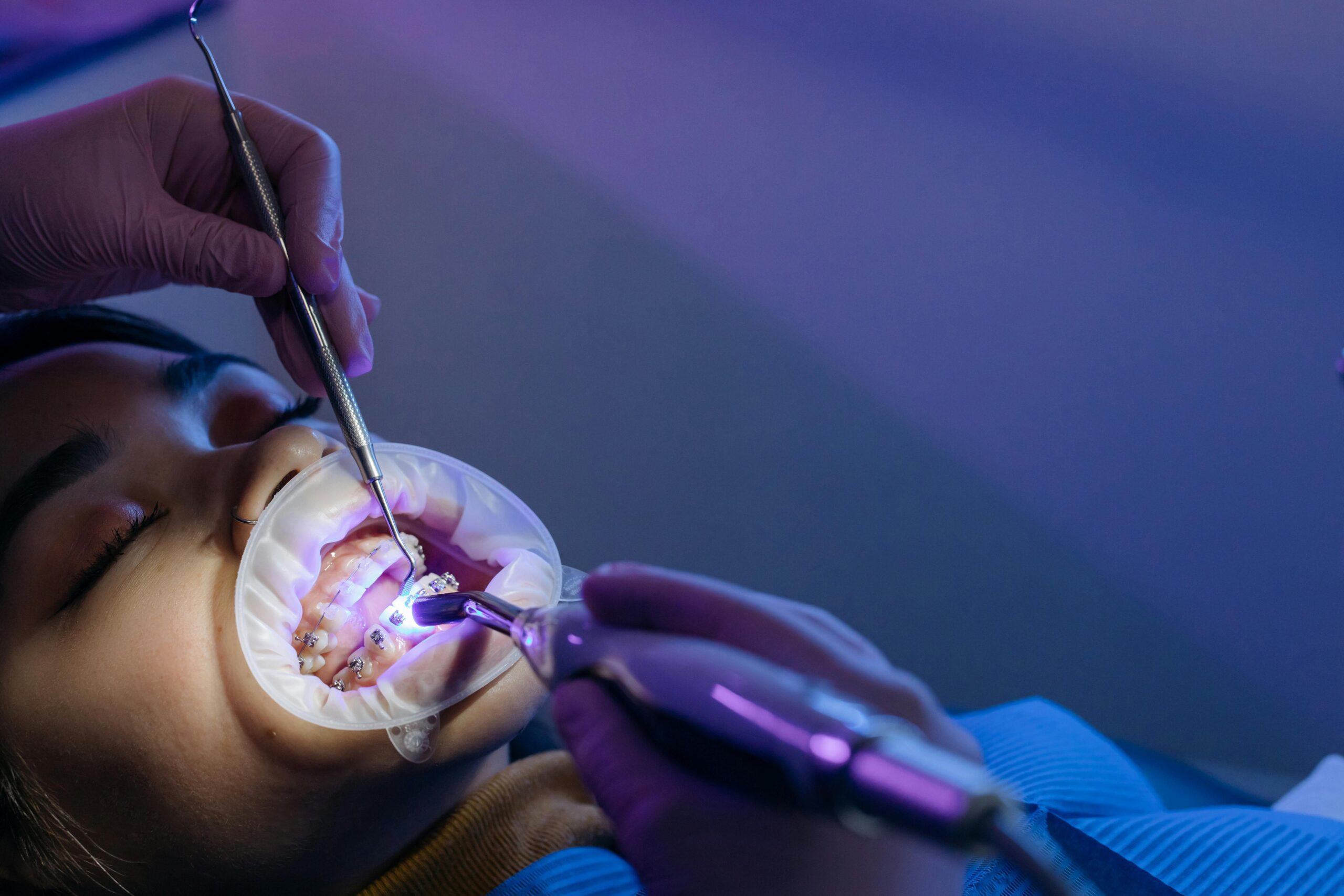 Dentist adjusting braces, which straighten teeth by gradually shifting them with gentle pressure.