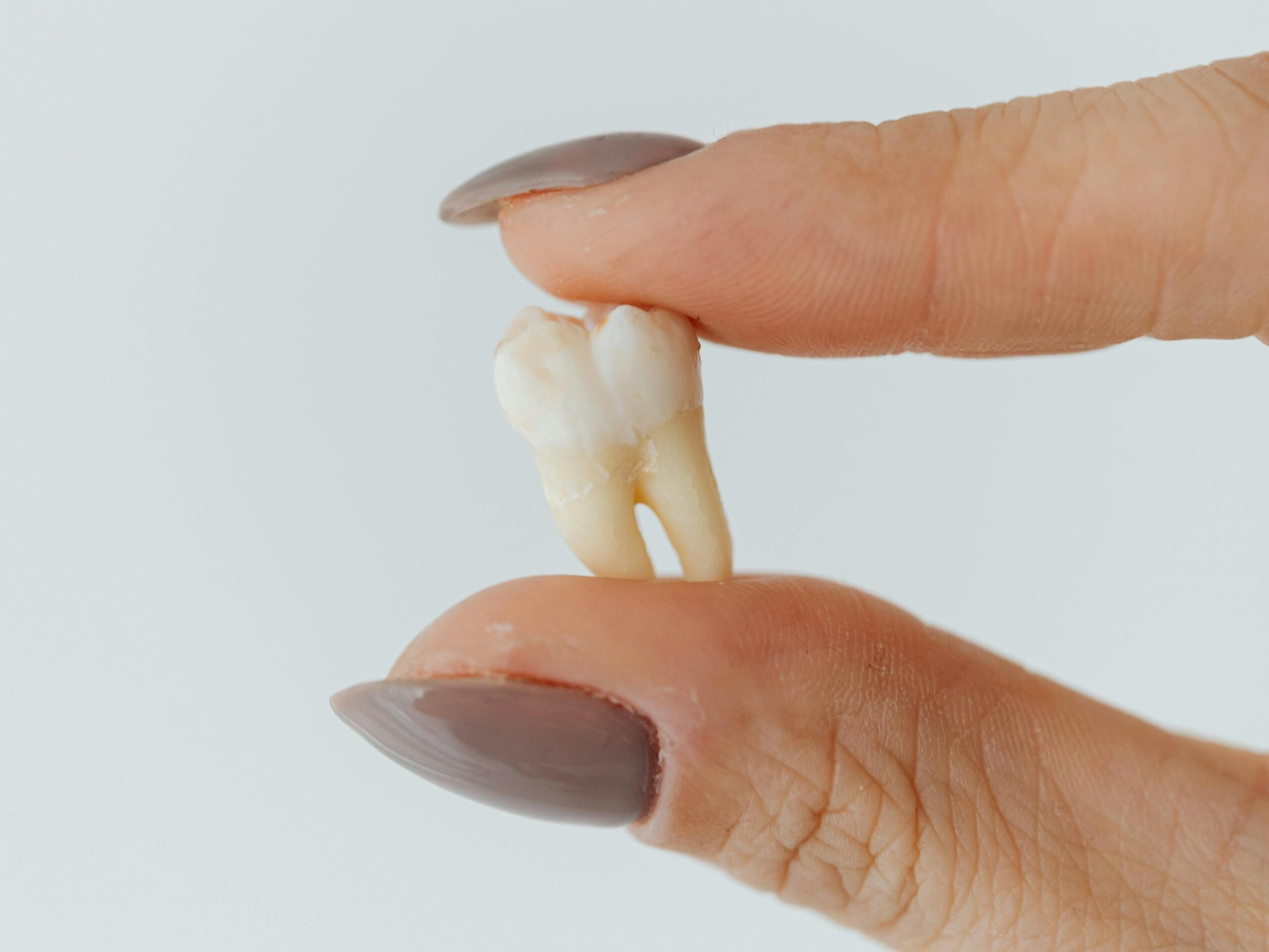 Hand holding a knock-out tooth between two fingers, dentistry.
